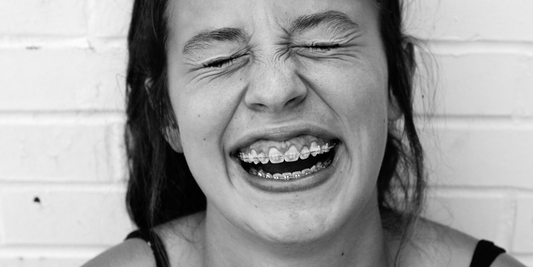 Braces