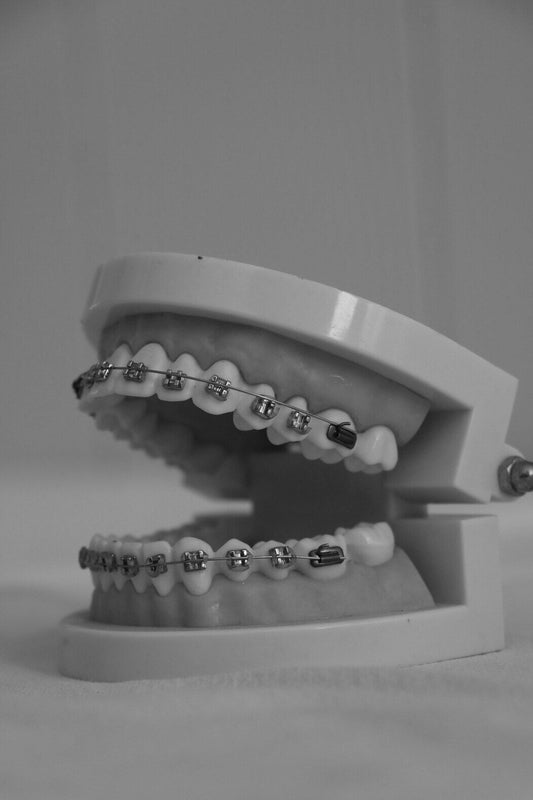 How to Floss with Braces