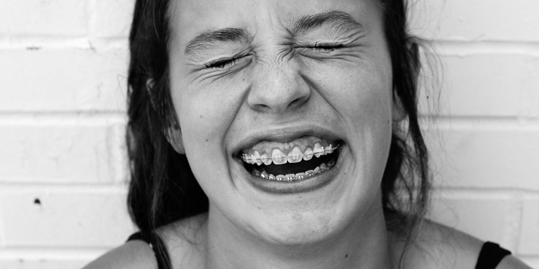 Braces