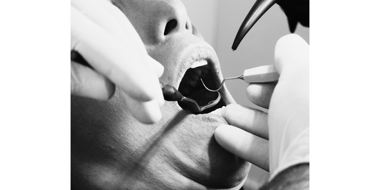 Periodontal Gum Disease