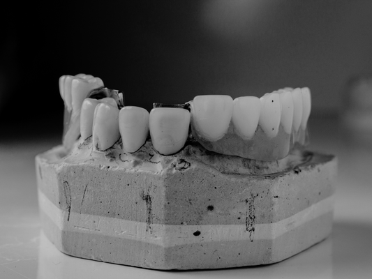 Crowns, Bridges & Veneers