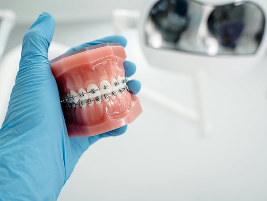 How to Floss with Braces