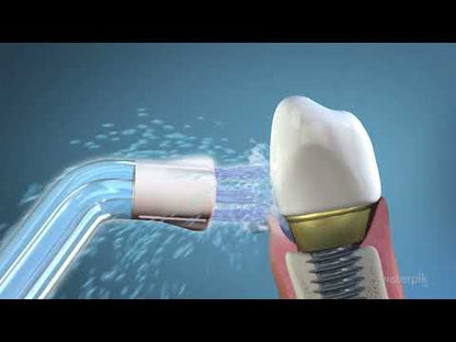 Embout implants, bridges et couronnes