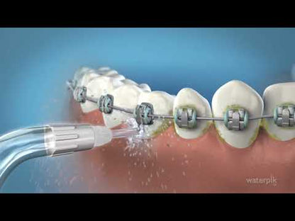 Embout orthodontique 