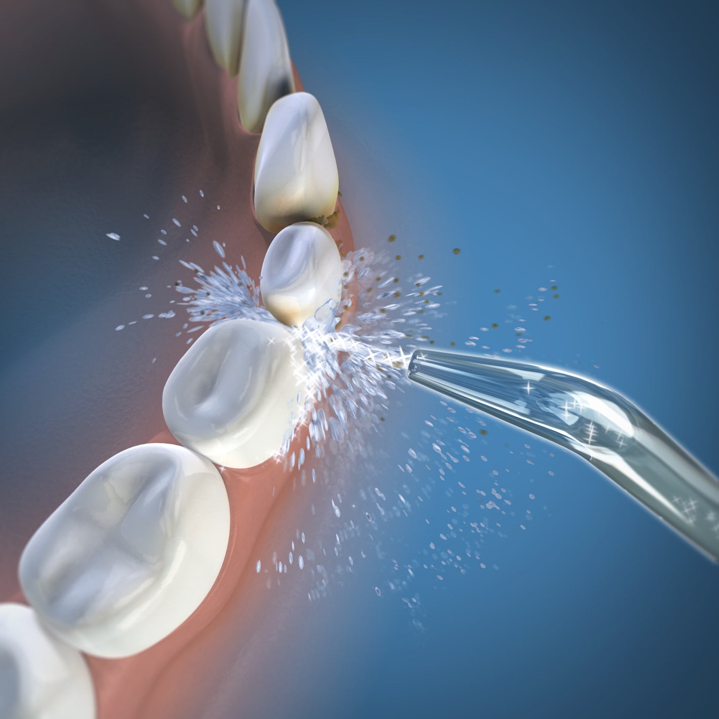 Using WJT-2E Whitening Classic Jet Tips