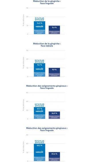 Jet Dentaire Waterpik® : 51 % Plus Efficace Que Le Fil Dentaire Pour Réduire La Gingivite