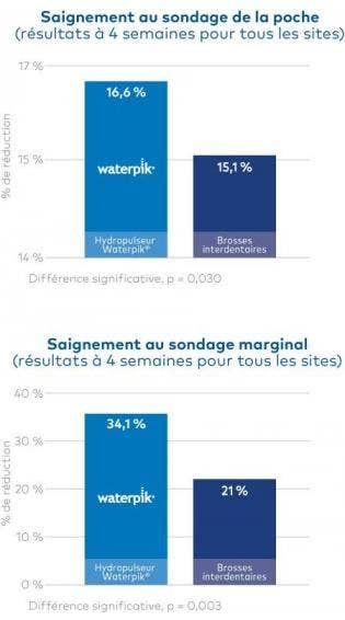 Le Jet Dentaire Waterpik® : Significativement Plus Efficace Qu’une Brosse Interdentaire Pour Améliorer La Santé Gingivale !