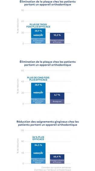 Le Jet Dentaire Waterpik® Est 3 Fois Plus Efficace Que Le Fil Dentaire Pour Les Patients Recevant Un Traitement Orthodontique