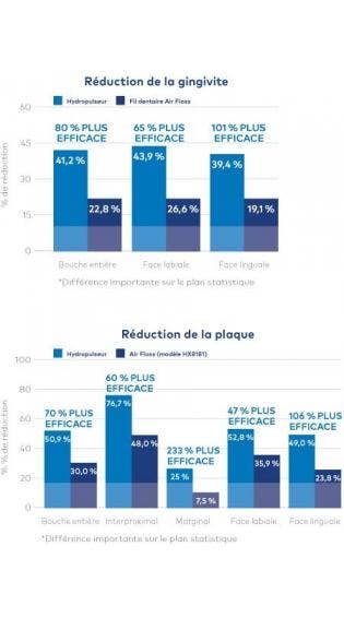  Jet Dentaire Waterpik® : 80 % Plus Efficace Que Le Sonicare® Air Floss